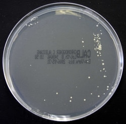 Thermo Scientific Oxoid Chromogenic Candida albicans Agar | Buy Online | Thermo Scientific&trade; | Fisher Scientific